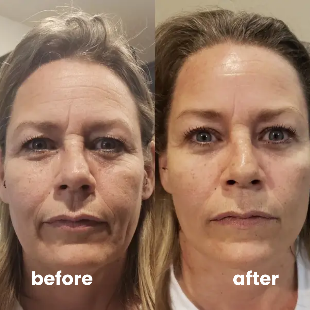 instant firmX cream