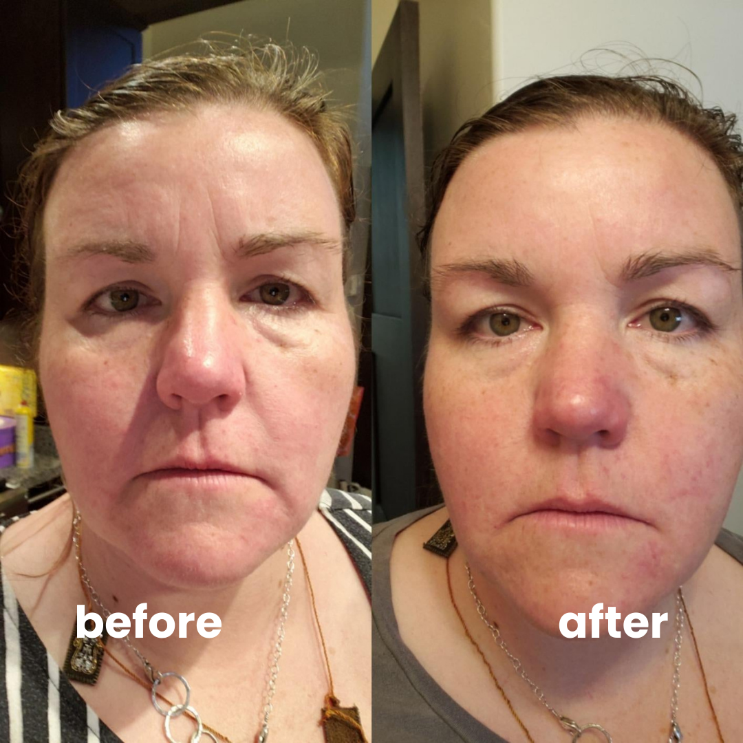 instant firmX cream