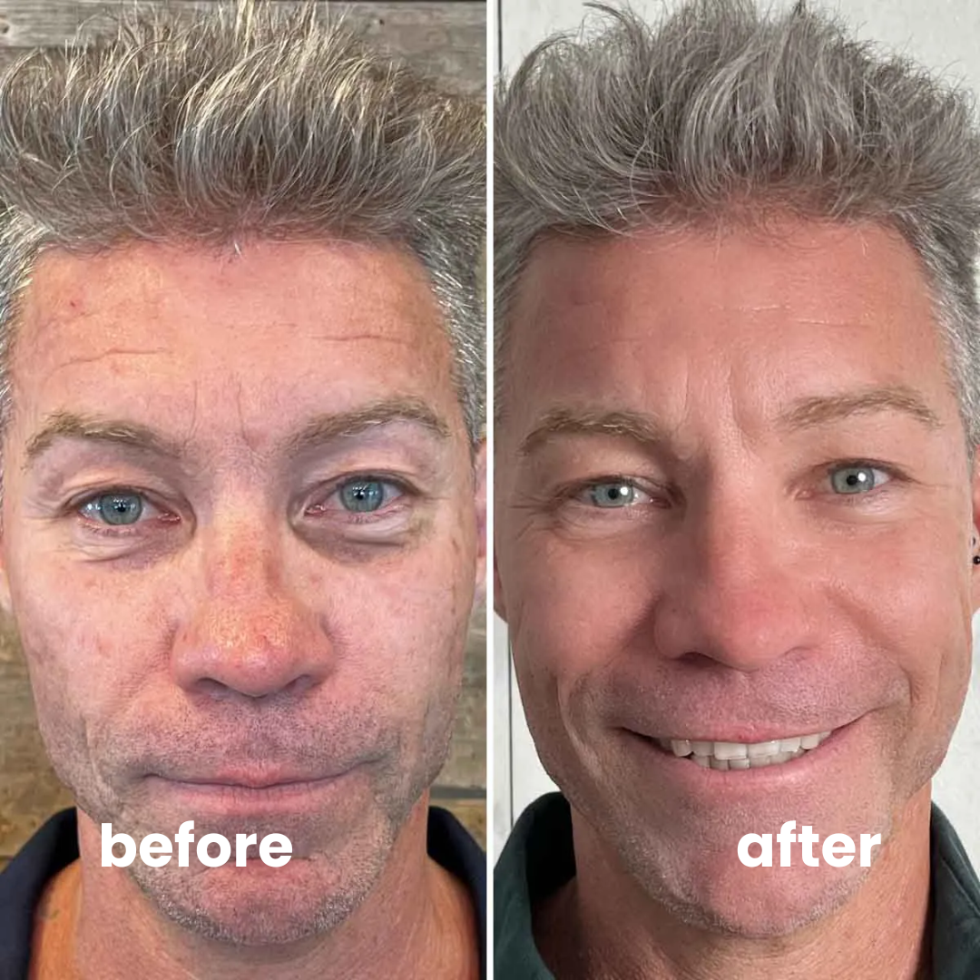 instant firmX cream
